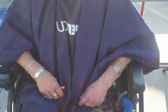 BEFORE: A homeless woman in a wheelchair before her hair cut.